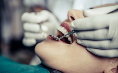 Caries dentales: causas, síntomas, tratamientos y prevención