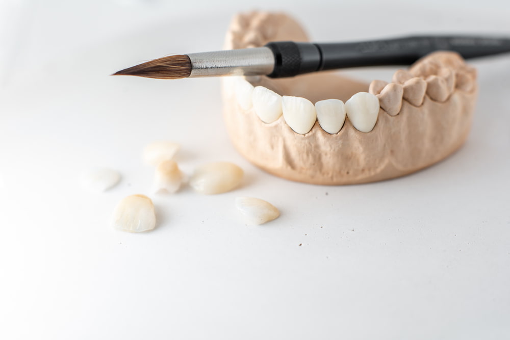 Fundas dentales en maqueta de boca, perfeccionadas por dentistas